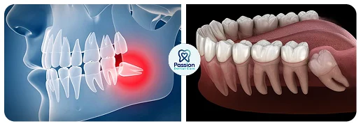 Hasil perawatan {{ result?.title }} Passion Dental Care