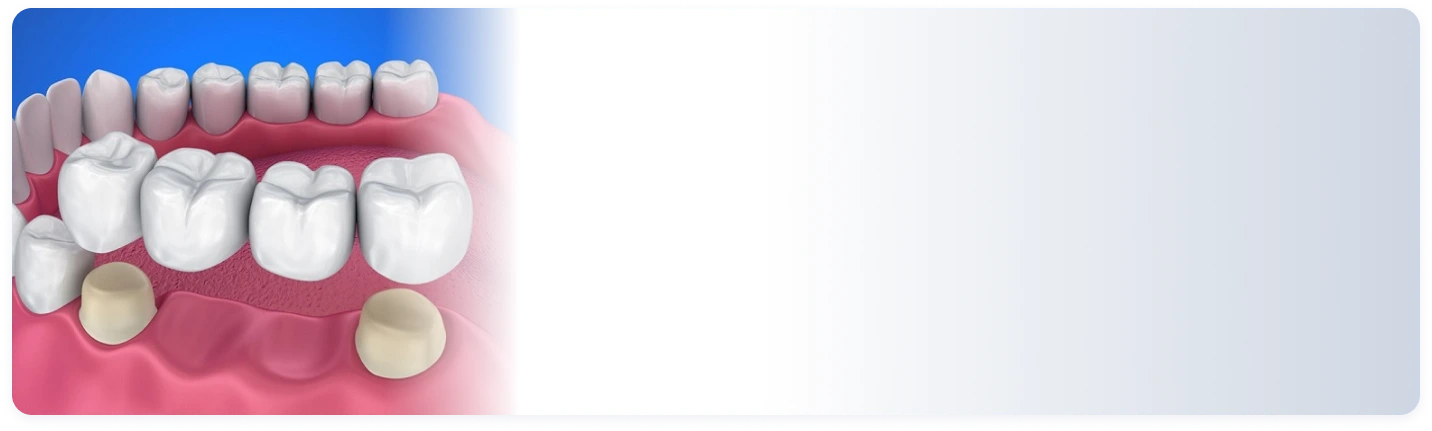 Layanan {{ result?.title }} Passion Dental Care