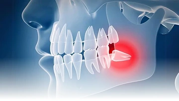 Layanan {{ result?.title }} Passion Dental Care