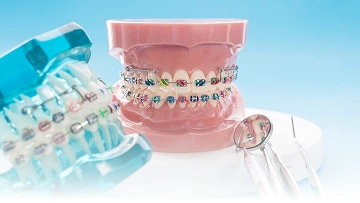 Layanan {{ result?.title }} Passion Dental Care