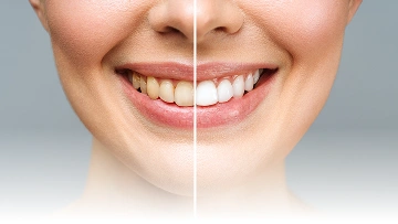 Layanan {{ result?.title }} Passion Dental Care