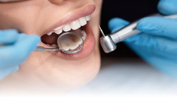 Layanan {{ result?.title }} Passion Dental Care