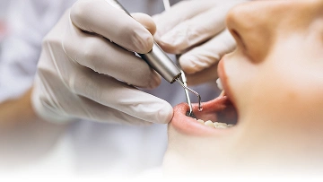 Layanan {{ result?.title }} Passion Dental Care