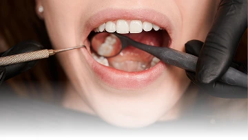 Layanan {{ result?.title }} Passion Dental Care