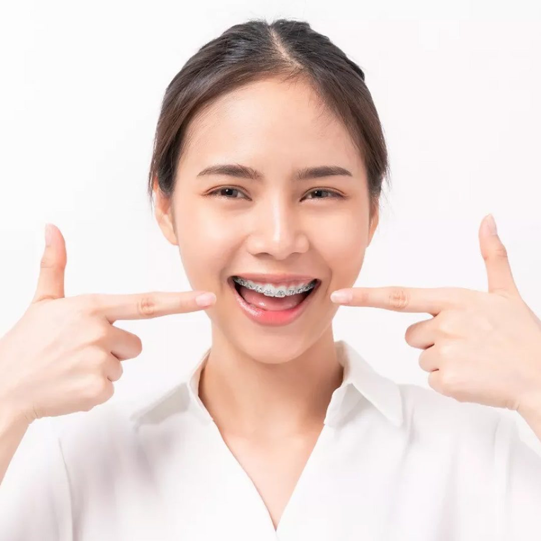 https://dev.passiondentalcare.com/wp-content/uploads/2022/12/behel-gigi-images-1-pdc.jpg