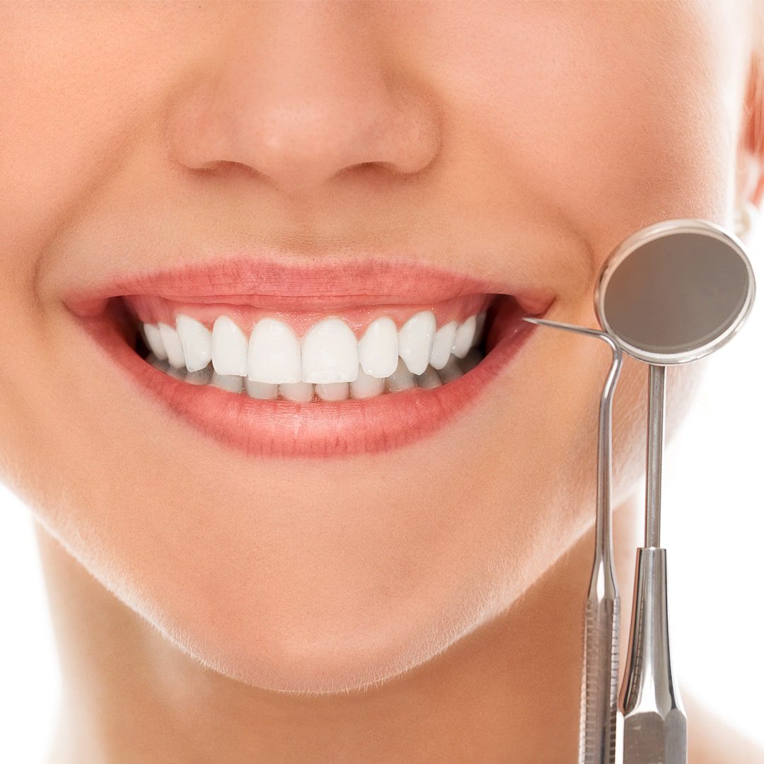 https://dev.passiondentalcare.com/wp-content/uploads/2022/12/gum-lifting-images-1-min.jpg