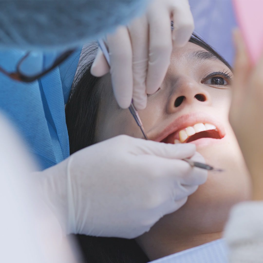 https://dev.passiondentalcare.com/wp-content/uploads/2022/12/tambalan-estetis-images-1-min.jpg
