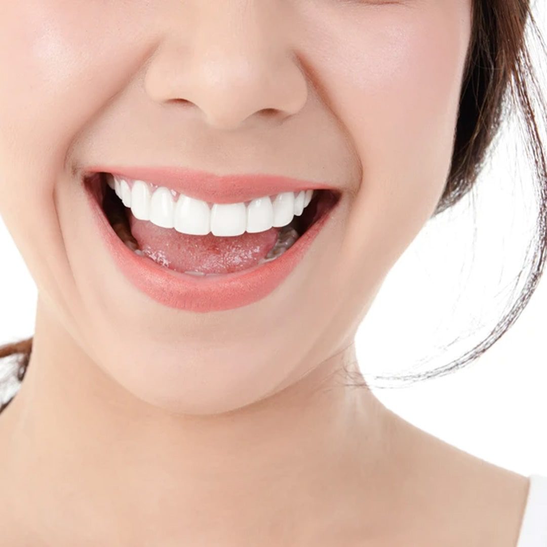 https://dev.passiondentalcare.com/wp-content/uploads/2022/12/veneer-images-1-min.jpg