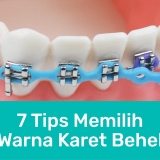 pilih warna karet behel 01 | Passion Dental Care